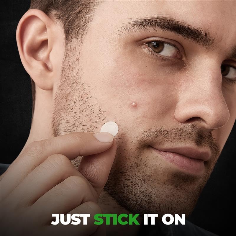 Beardo Acne Pimple Patch for Face with Salicylic Acid (72 dots) | Waterproof Patches for Active Acne | Absorbs Pimple Overnight and Reduces Excess Oil | Pimple