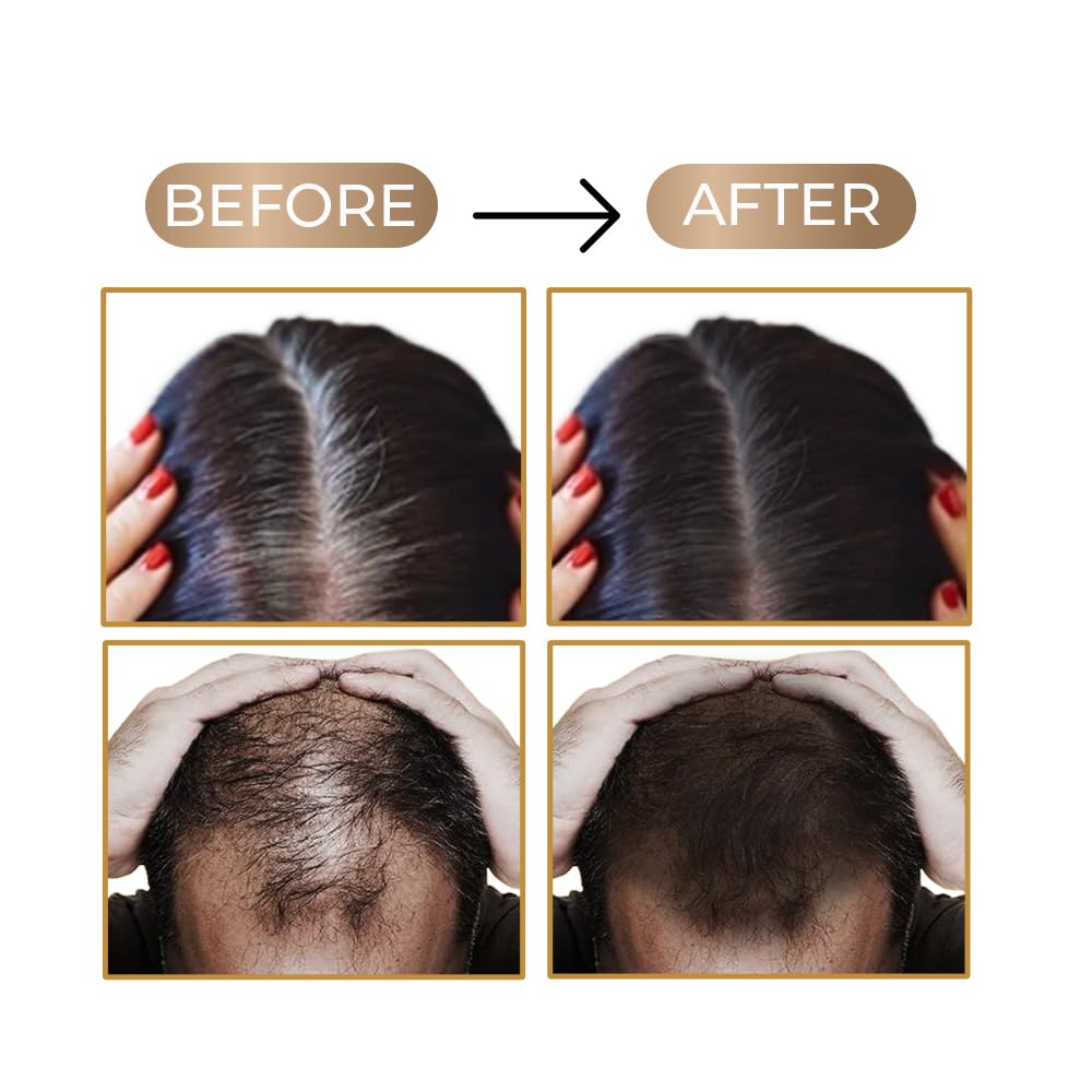Streax Hair Root Touch Up for Grey Hair, Black – 4gm | Hair Cover Up Powder I Covers Grey Hair & Bald Patches | Instant Hair Colour Touch Up, Beard touch up for