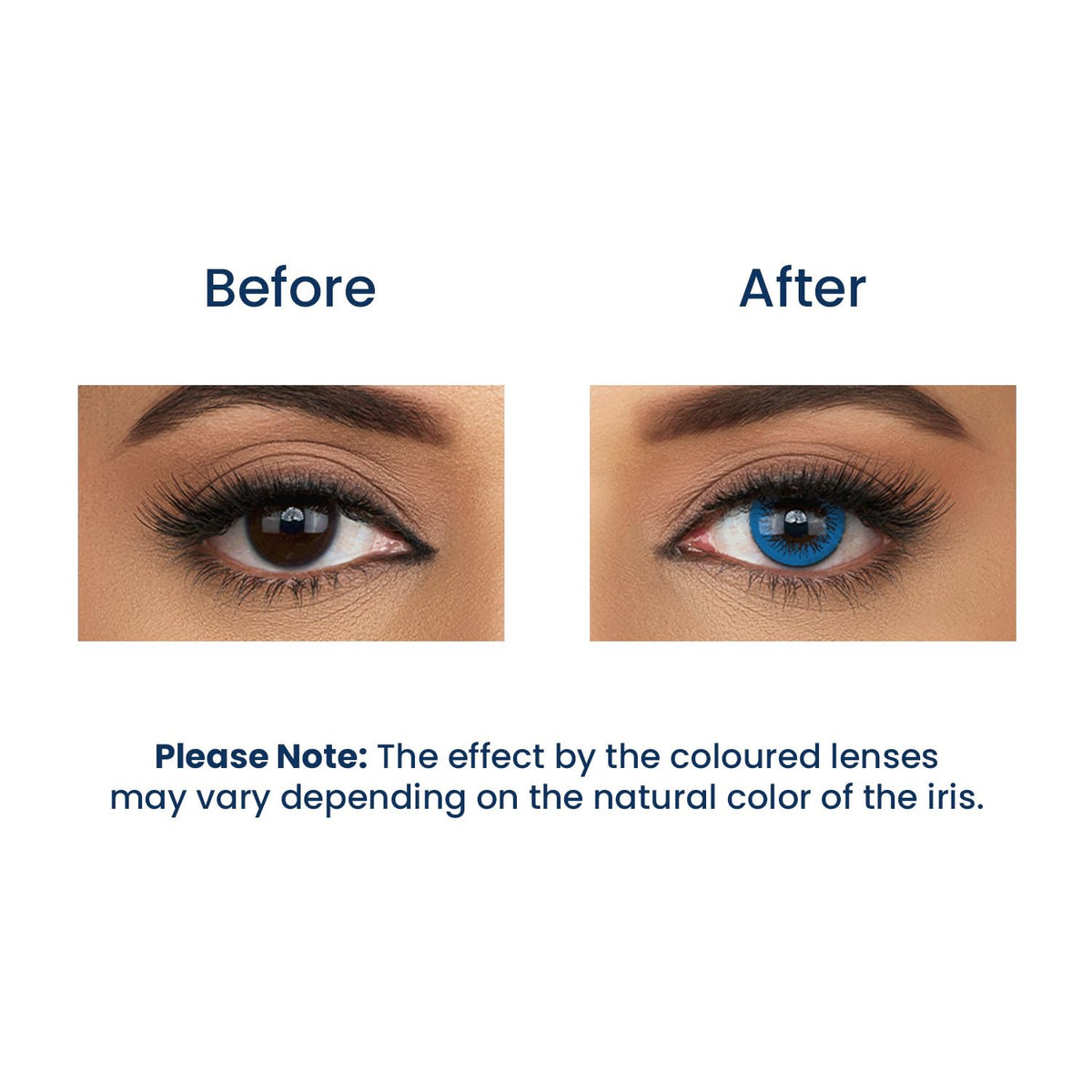 Aqualenses Aquacolor Submarine Blue Candy Pack Zero Power Colored Lenses (2 Lens/Box)