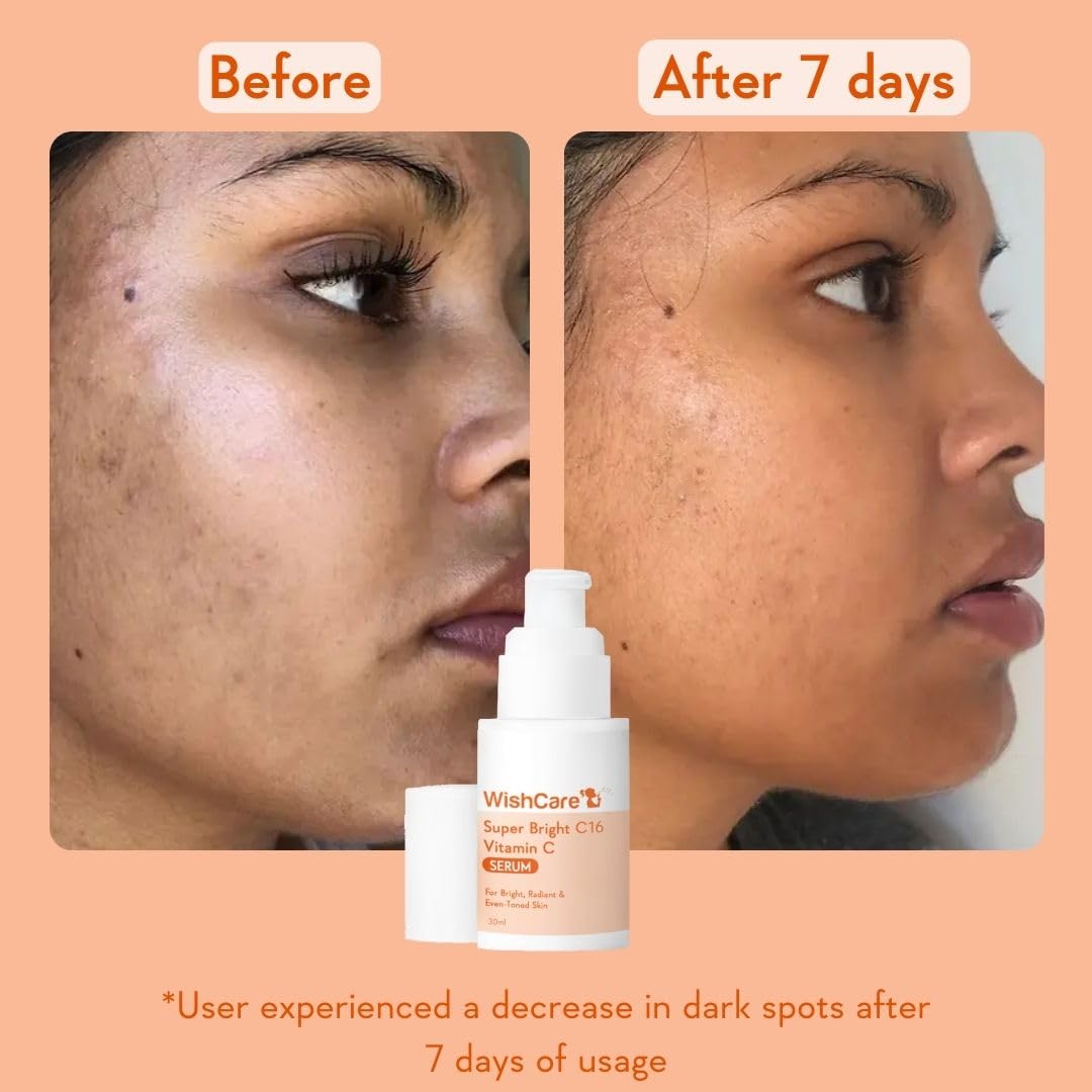 WishCare Vitamin C Face Serum with Niacinamide, Ferulic Acid & Botanical Extracts – Serum for All Skin Types, 30ml