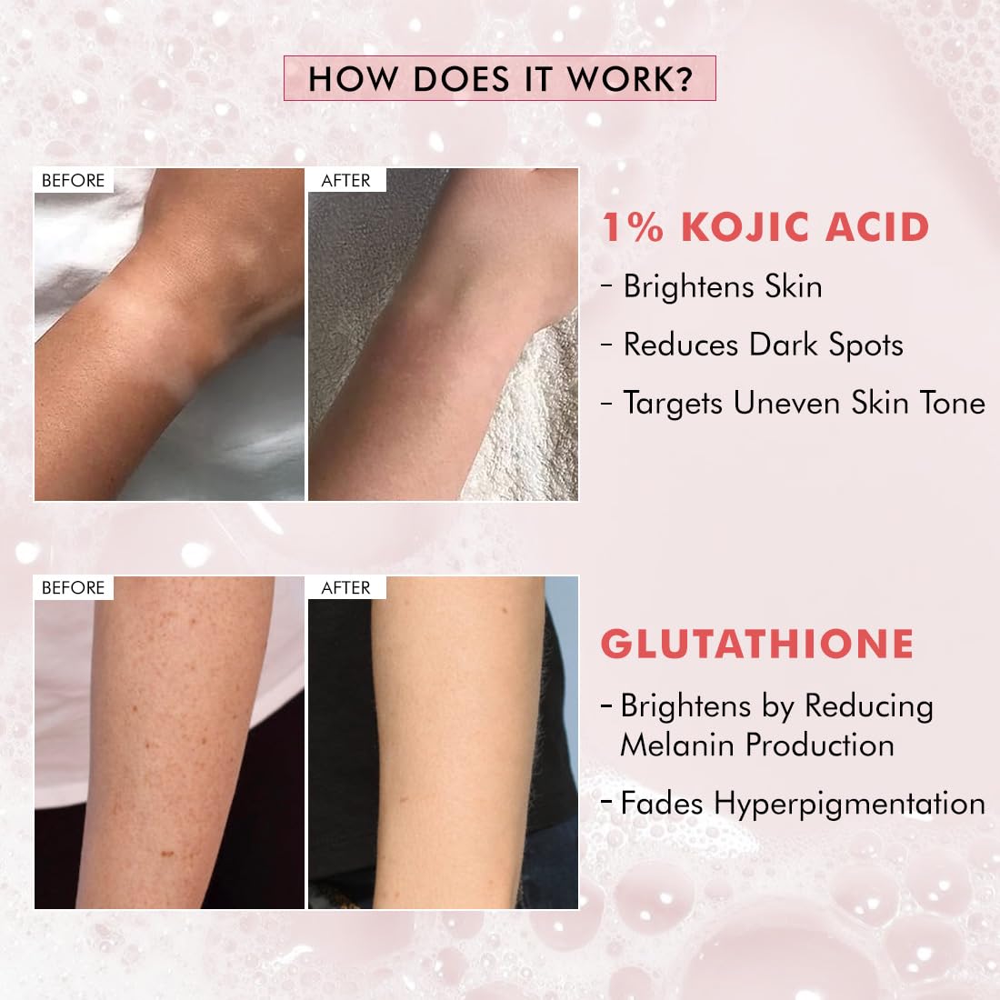 mCaffeine Brightening Tan Removal Soap - 1% Kojic Acid & Glutathione -Pack of 3x100g | Niacinamide, Glycolic Acid - Reduce Dark Spots | Tangy Guava Perfumed Bar