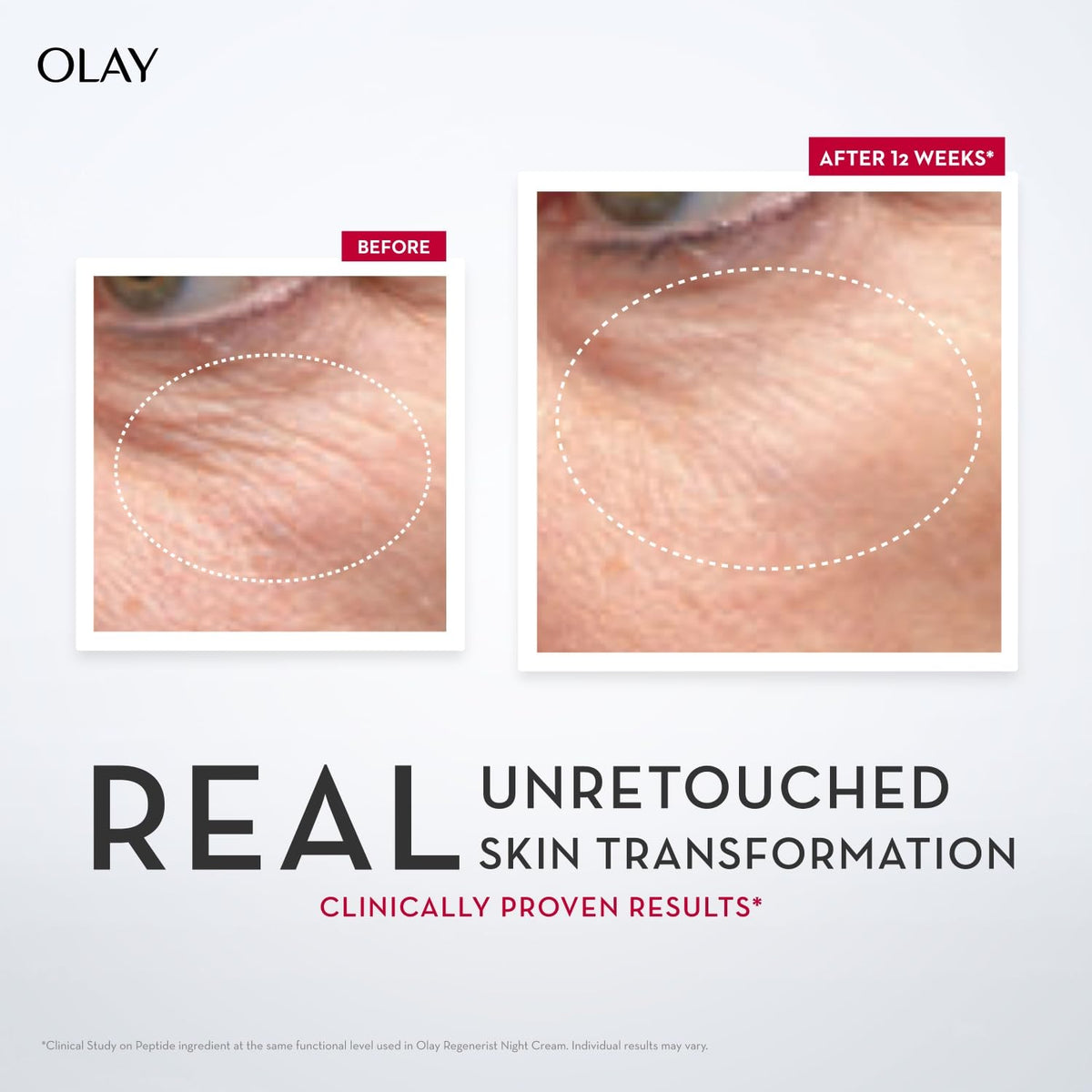 Olay Regenerist Micosculpting Serum | Hydrated, Plump, Bouncy Skin | With Hyaluronic Acid, Niacinamide and Peptides | Normal, Oily, Dry, Combination Skin | 50ml