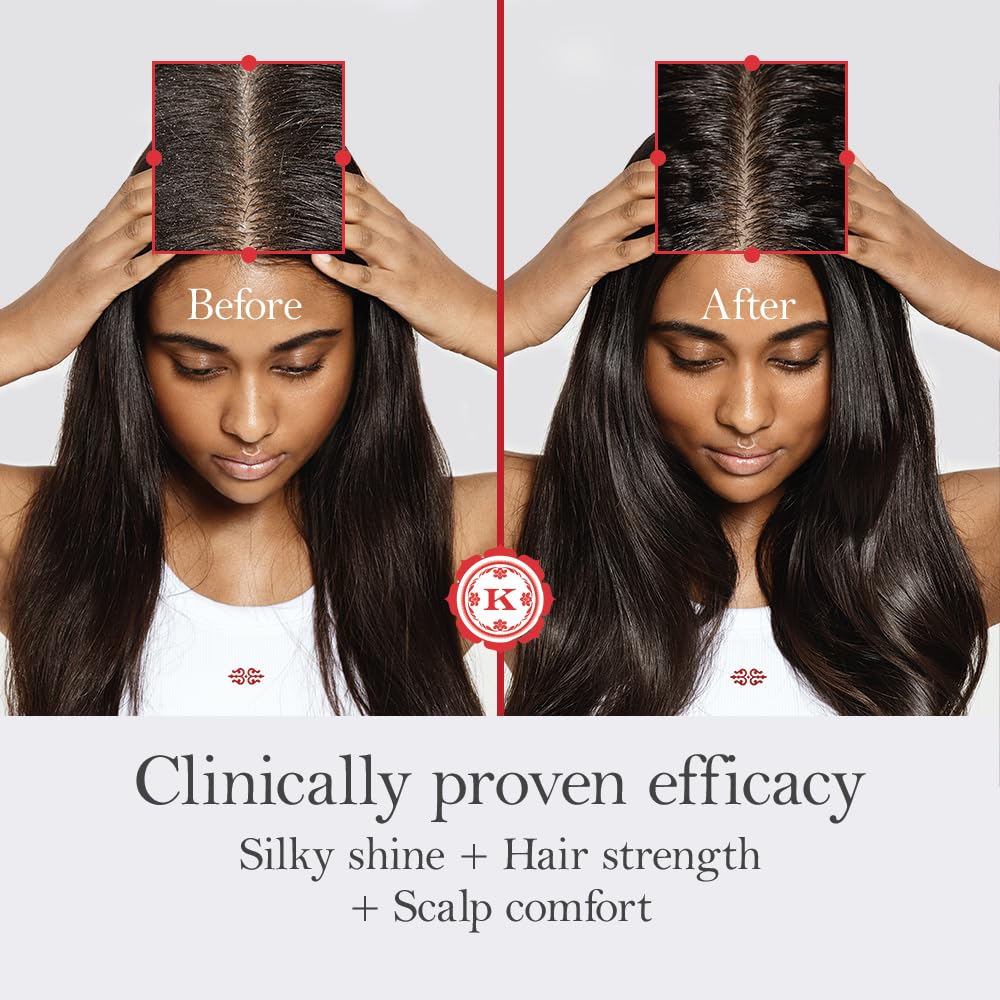 BRINGARAS BALANCING SCALP & HAIR OIL 100 ML Stimulates Hair Growth | Rebalances Scalp Health