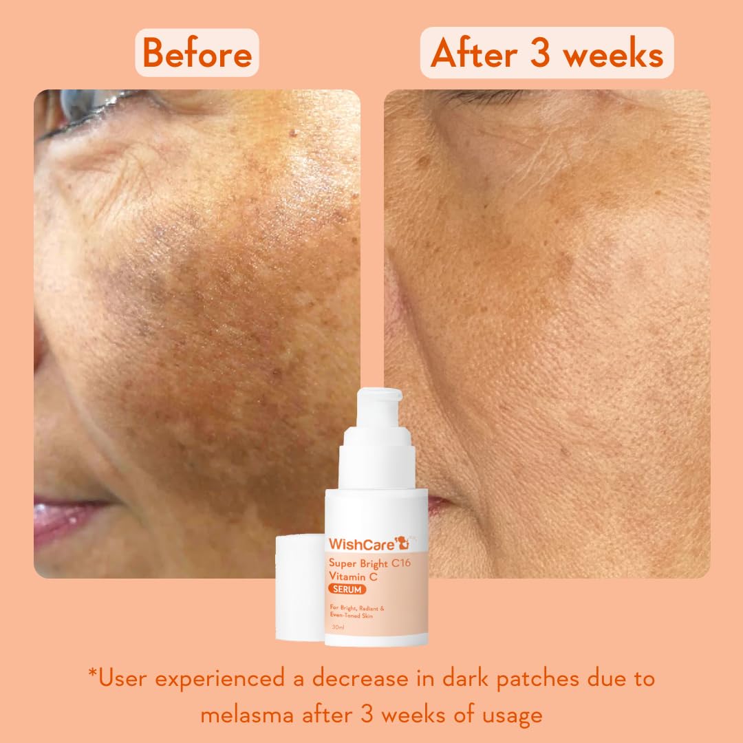 WishCare Vitamin C Face Serum with Niacinamide, Ferulic Acid & Botanical Extracts – Serum for All Skin Types, 30ml