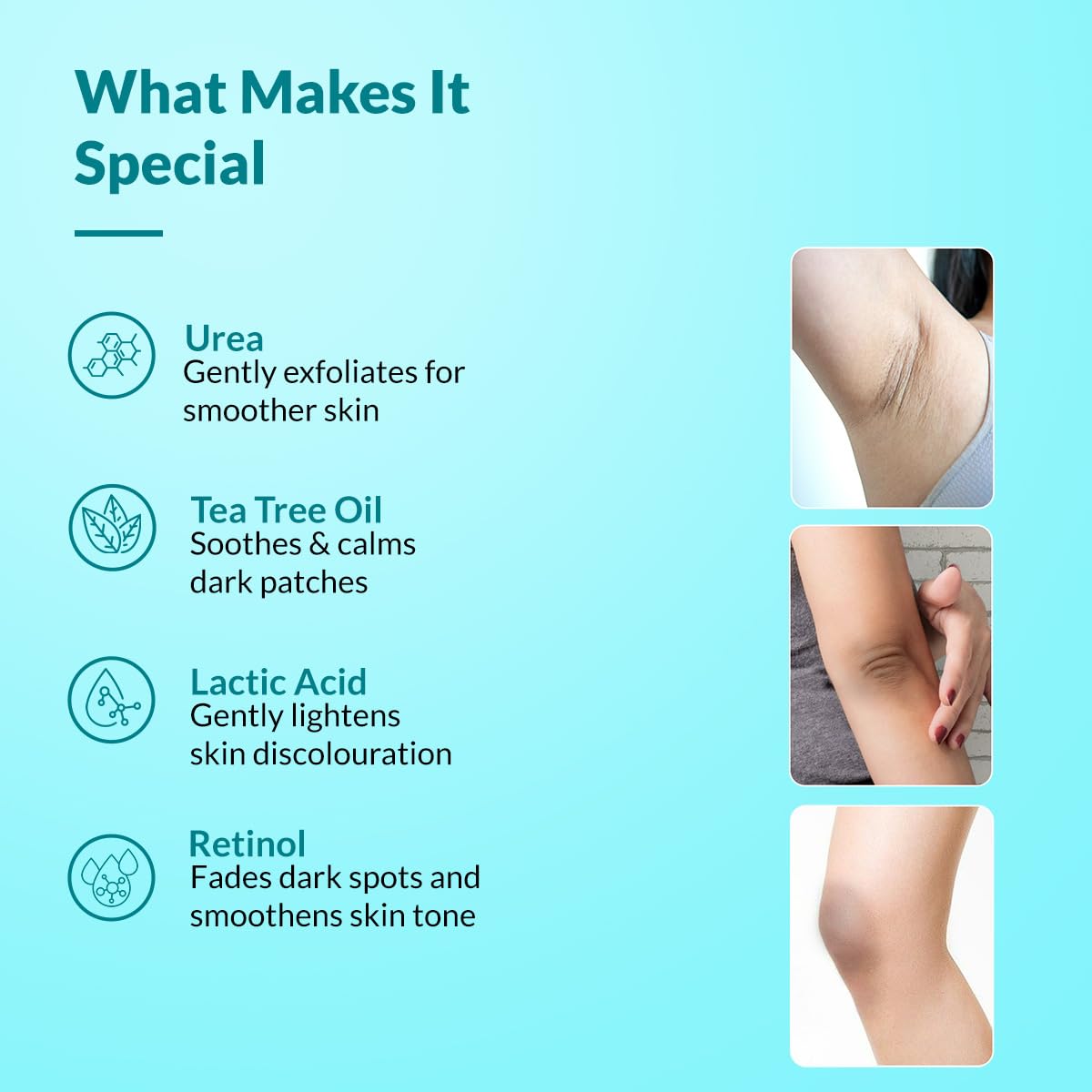 Fixderma Nigrifix Cream for Acanthosis Nigricans with Lactic Acid | Dermatologist Tested Retinol Cream | For Dark Body Parts like Neck, Ankles, Knuckles, Armpit
