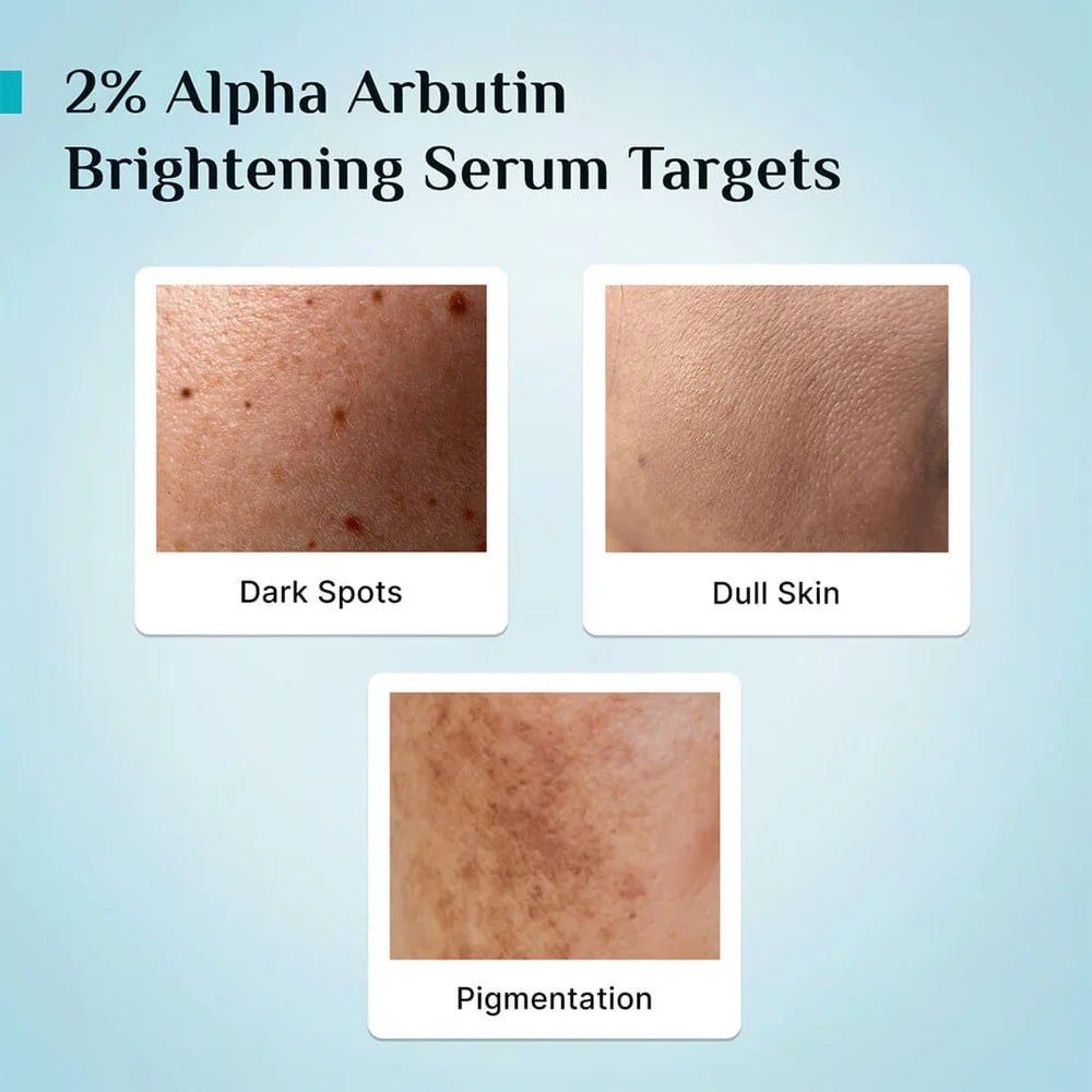 pilgrim 2% Alpha Arbutin Brightening Serum With 3% Vitamin C 30ml