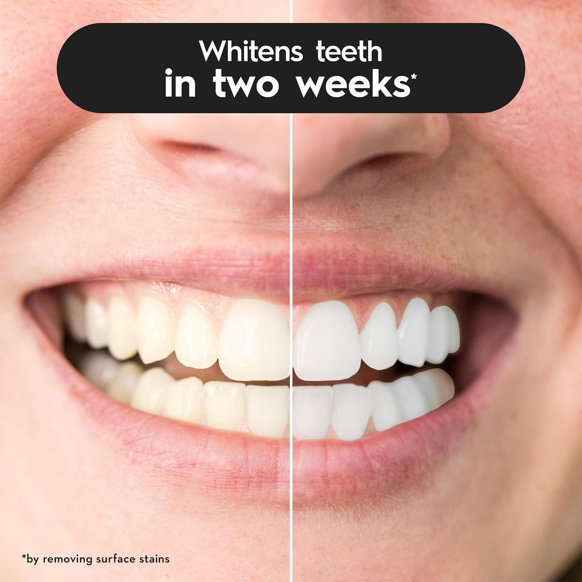 Oral-B 3D White Charcoal Soft Manual Toothbrush For Adults, Whitens Teeth in 2 Weeks, Soft Bristles, Multicolour Tooth Brush Whitening Set, Dentist Recommended