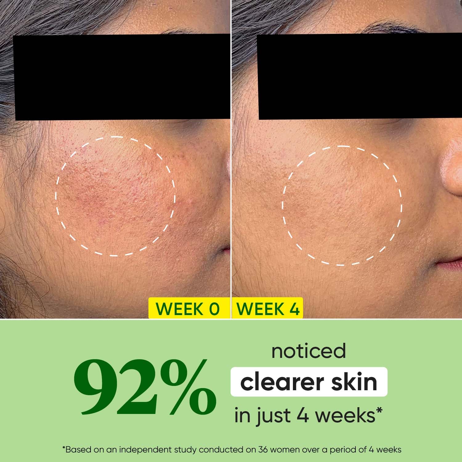 DOT & KEY - Cica + Niacinamide Oil-Free Face Moisturizer Jar (60ML)