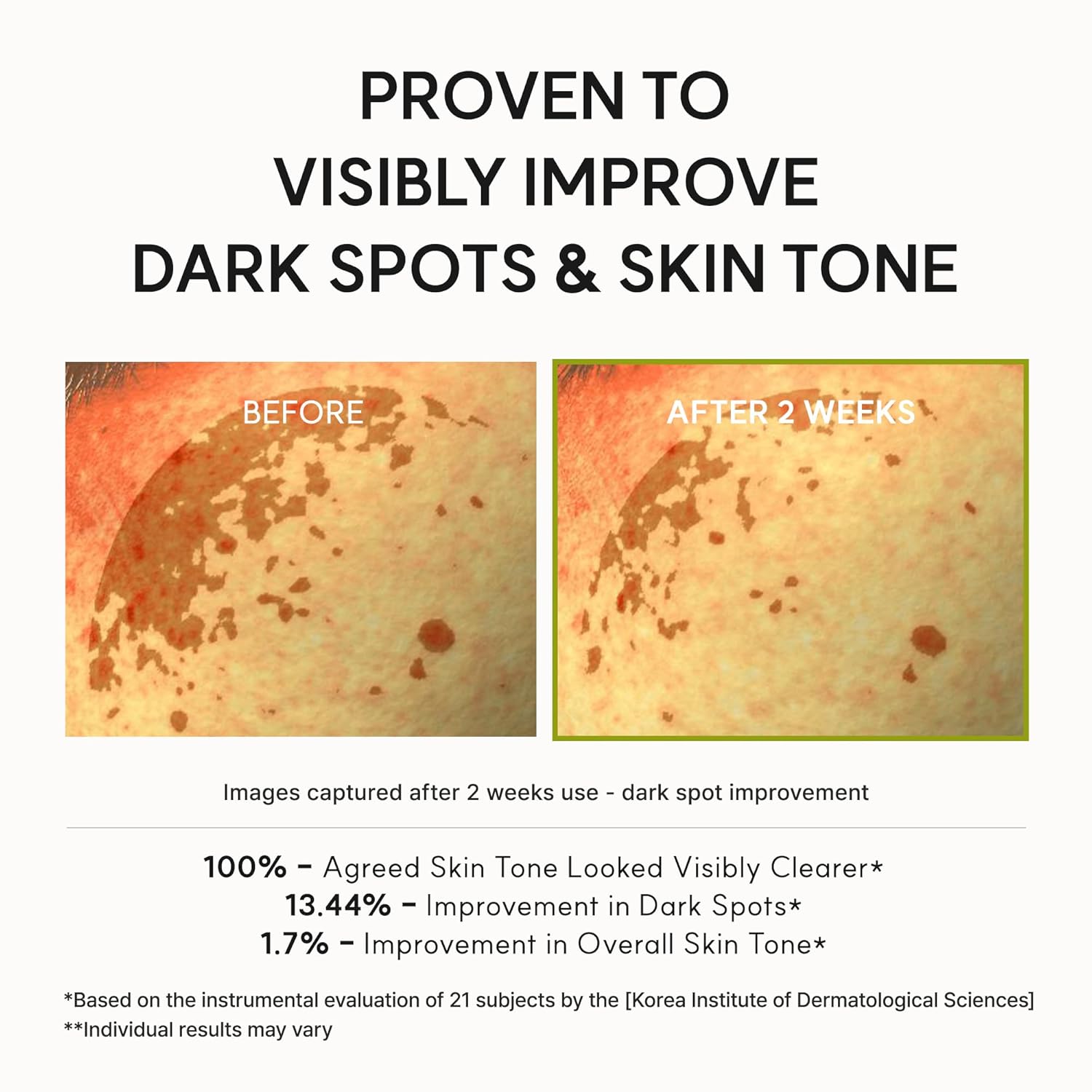 Arencia Vitamin C Booster Serum with Glutathione, Niacinamide, and Vitamin E 30mL | Korean Cosmetics | Skincare Serum | Improves Skin Tone and Radiance