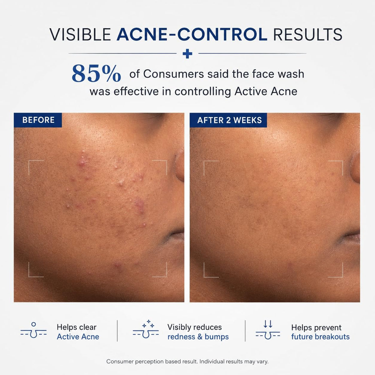 The Derma Co 1% Salicylic Acid Gel Face Wash with Salicylic Acid & Witch Hazel for Active Acne - 100 ml 100 ml (Pack of 1)