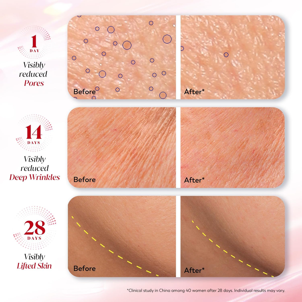 Olay Regenerist Ultra Firming Serum | PHCA, Bakuchiol, Collagen Peptide | Firm and Smooth Skin from Day 1 | Lightweight Texture | Dermatologist Tested | All Ski