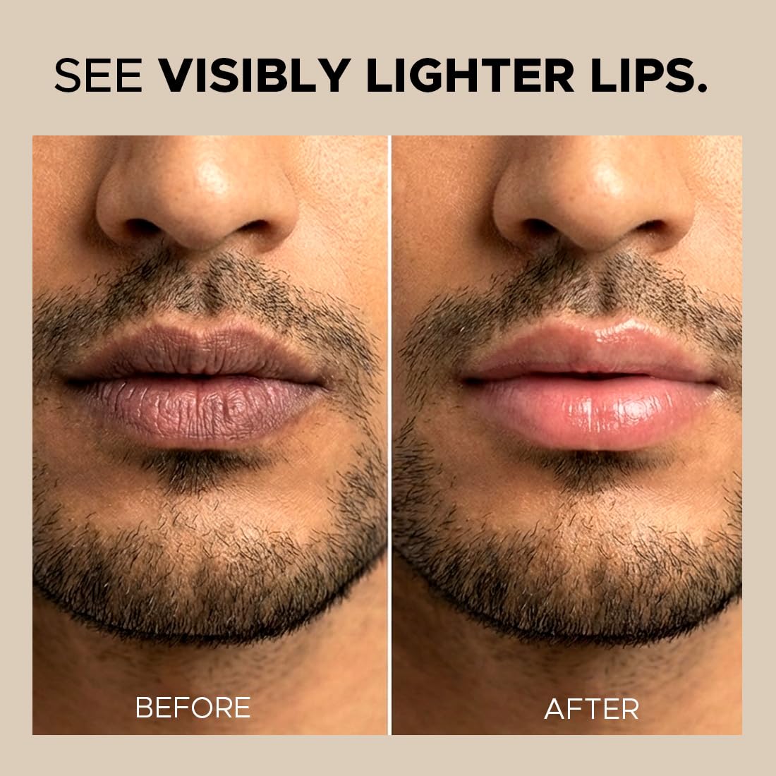 The Man Company Lightening Lip Balm| For Man | Brightens Lips | Non Tinted | Sun Protection with SPF50 | Hydrates | Fades Lip Pigmentation | Kojic Acid & Shea B