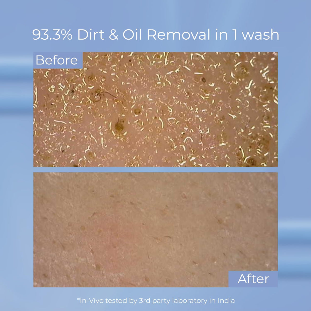 SKINQ Niacinamide Face Wash for Oily Skin & Excess Oil | Removes 93.3% Dirt & Oil in One Wash | pH Balanced, No Parabens | Normal, Dry & Sensitive Skin | Made b