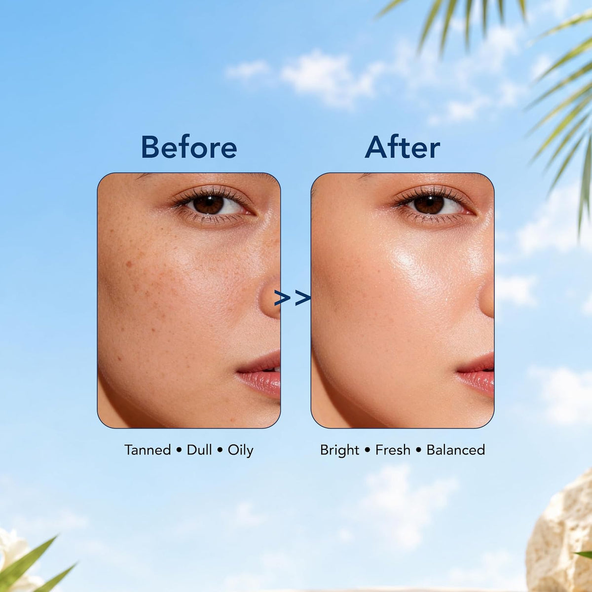 DR.RASHEL Beauty Elixirs De-Tan Face Pack for Glowing Skin, Oil Control, Acne, Pimples, Detan, Blemishes, Pigmentation & Brightening for Men & Women (380 Ml)