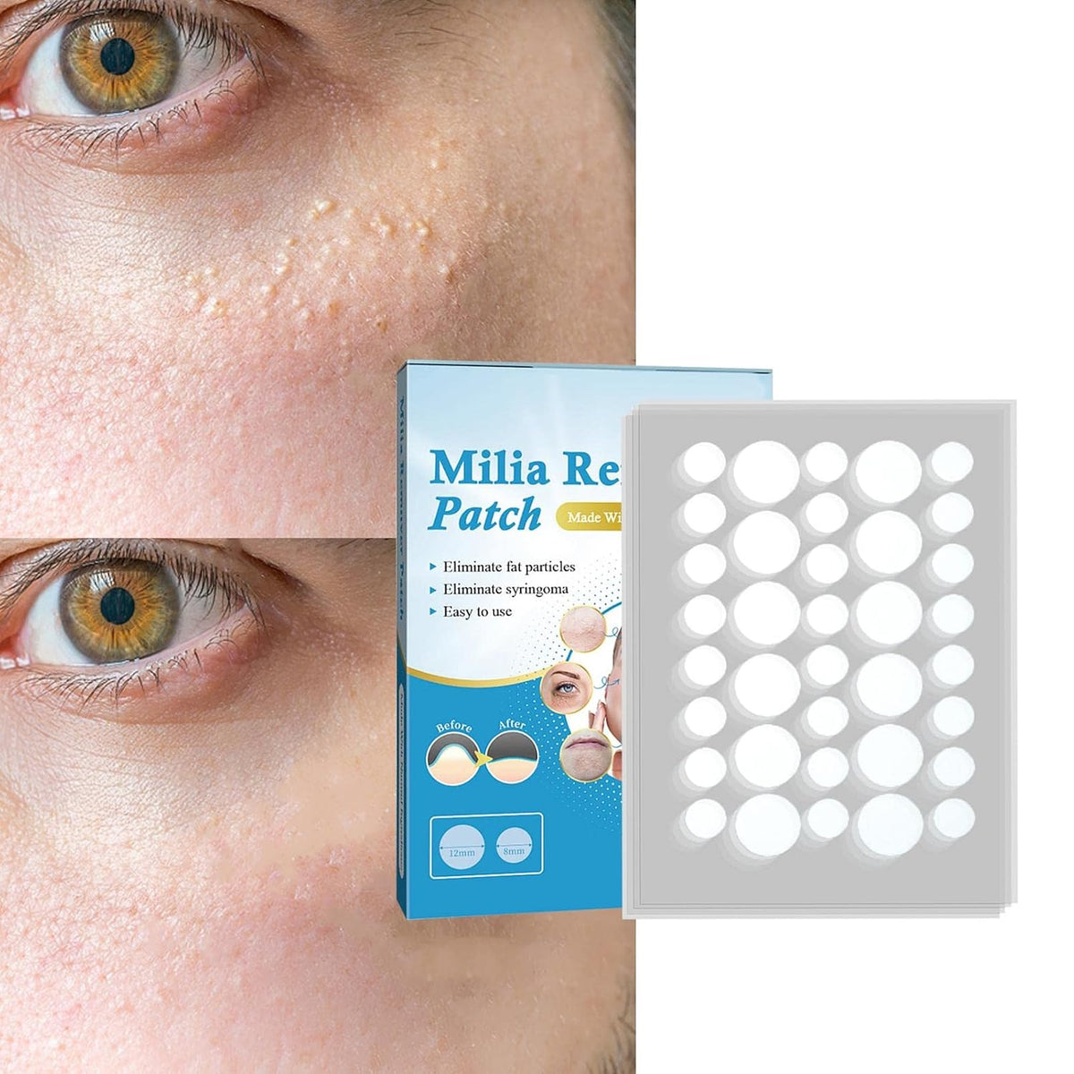 ECOMISTIQ® Pimple Patch Milia Remover Patch Sticker Moisturize Clean | Hydrocolloid Roll Compatible | Acne Spot Corrector Gel Replacement Accessory Kit