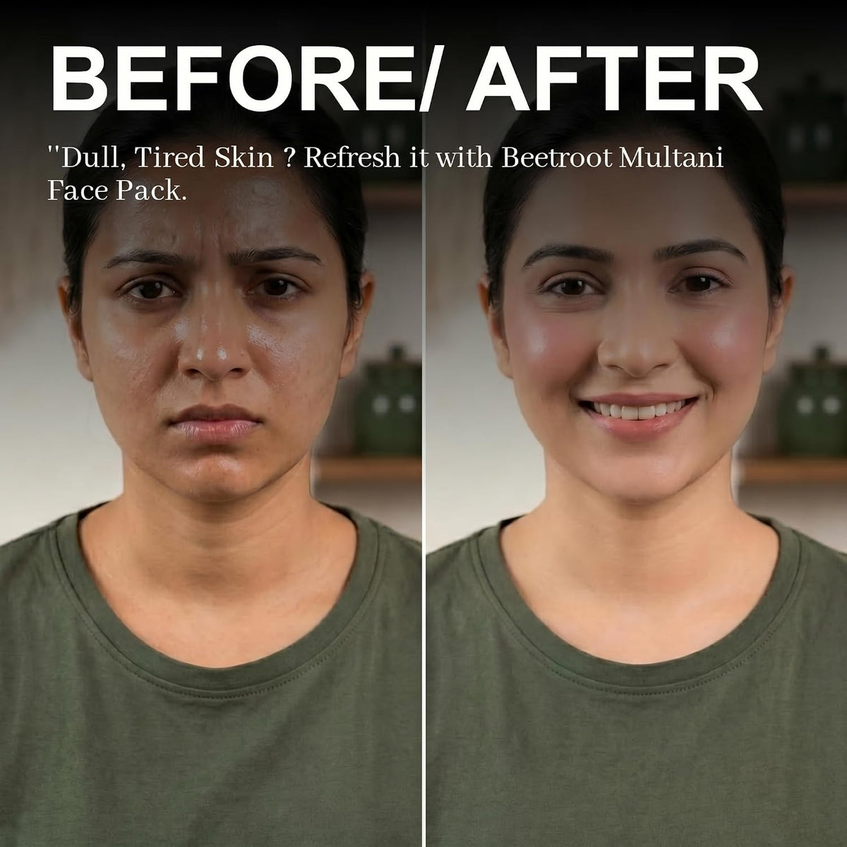 Beetroot Multani Mitti Face Pack 300g | Natural Herbal Face Pack for Pink Glow & Skin Brightening | Oil Control & Deep Cleansing | Ayurvedic Skincare | For Face