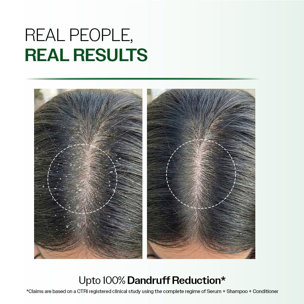 Bare Anatomy Advanced Anti-Dandruff Serum | Helps Reduce Dandruff | 50 ml