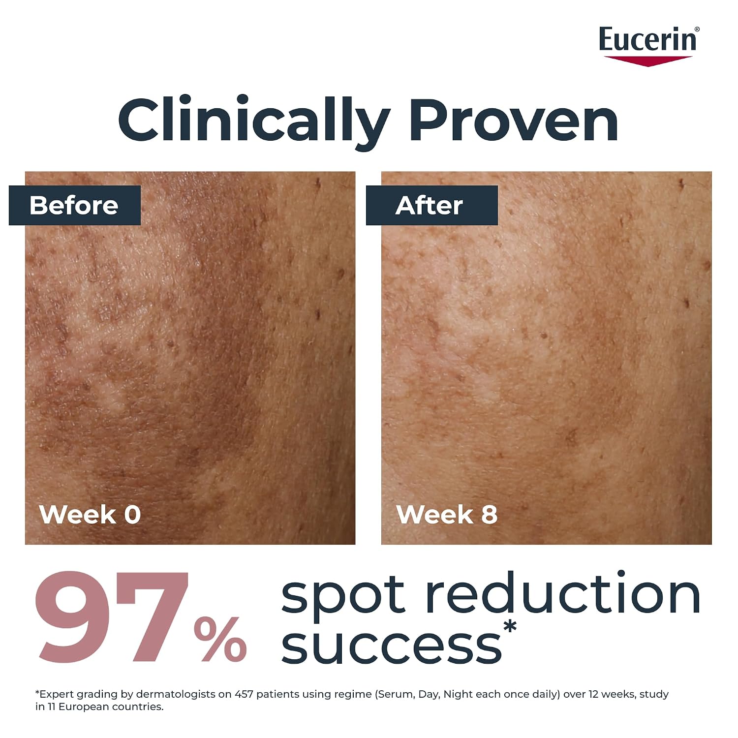 Eucerin Anti-Pigment Face Night Cream with Thiamidol, Reduces Dark Spots and Regenerates Skin 50ml