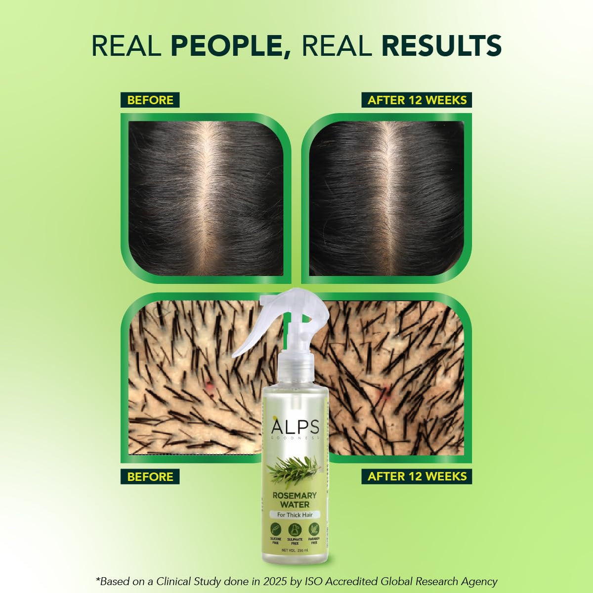Alps Goodness Rosemary Water Spray for Hair Growth (250ml) | Clinically Proven (In Vivo Tested) to Reduce Hair Fall & Promote Regrowth | 100% Natural Rosemary E