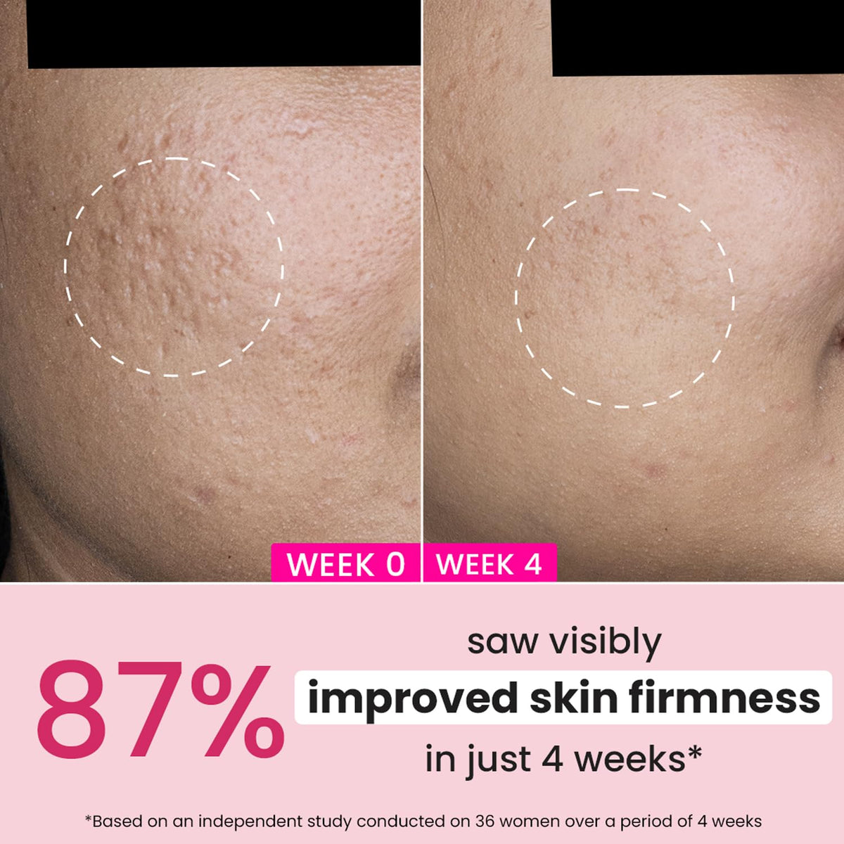 DOT & KEY Pomegranate + Multi-Peptide Anti Aging Cream With Spf 30 For Sun Protection|Reduces Fine Lines&Wrinkles|48Hr Intense Moisturization|Boosts Collagen|Fo