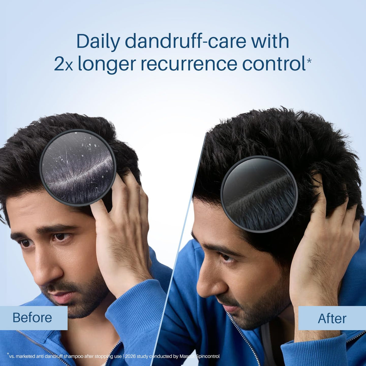 Scalpe Pro Daily Anti-Dandruff Shampoo | Removes Dandruff from Source | Prevents Itching & Irritation | Scalpe Science | Climbazole Formulation | Dermatological