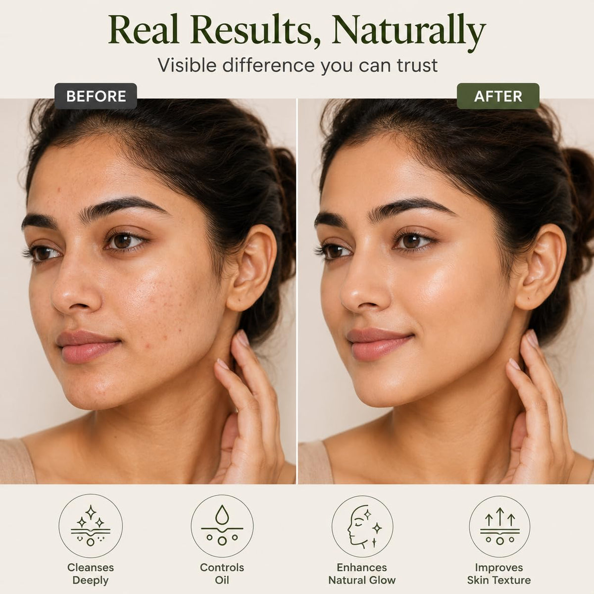 Multani Mitti Powder for Skin and Hair | Multani Mitti with Bowl and Brush | Natural Fullers Earth Face Pack for Oily & Acne Prone Skin 400g
