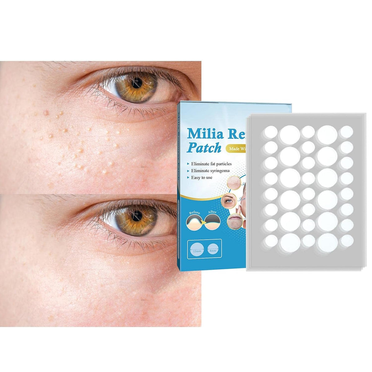 ECOMISTIQ® Pimple Patch Milia Remover Patch Sticker Moisturize Clean | Hydrocolloid Roll Compatible | Acne Spot Corrector Gel Replacement Accessory Kit