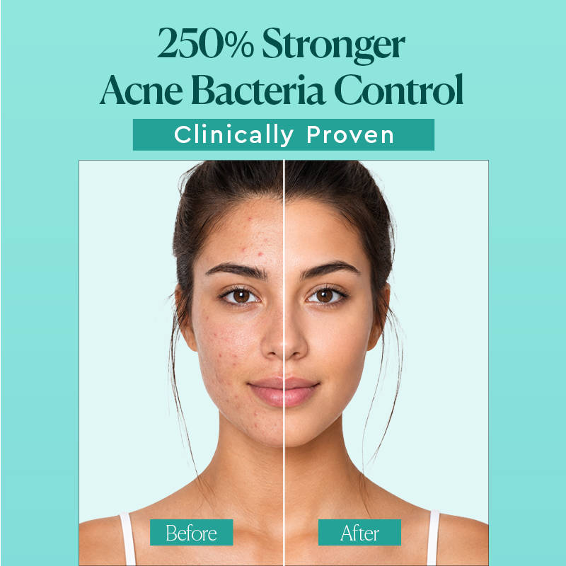 The Face Shop Dr Belmeur Korean Gel Cleanser For Acne Prone Skin