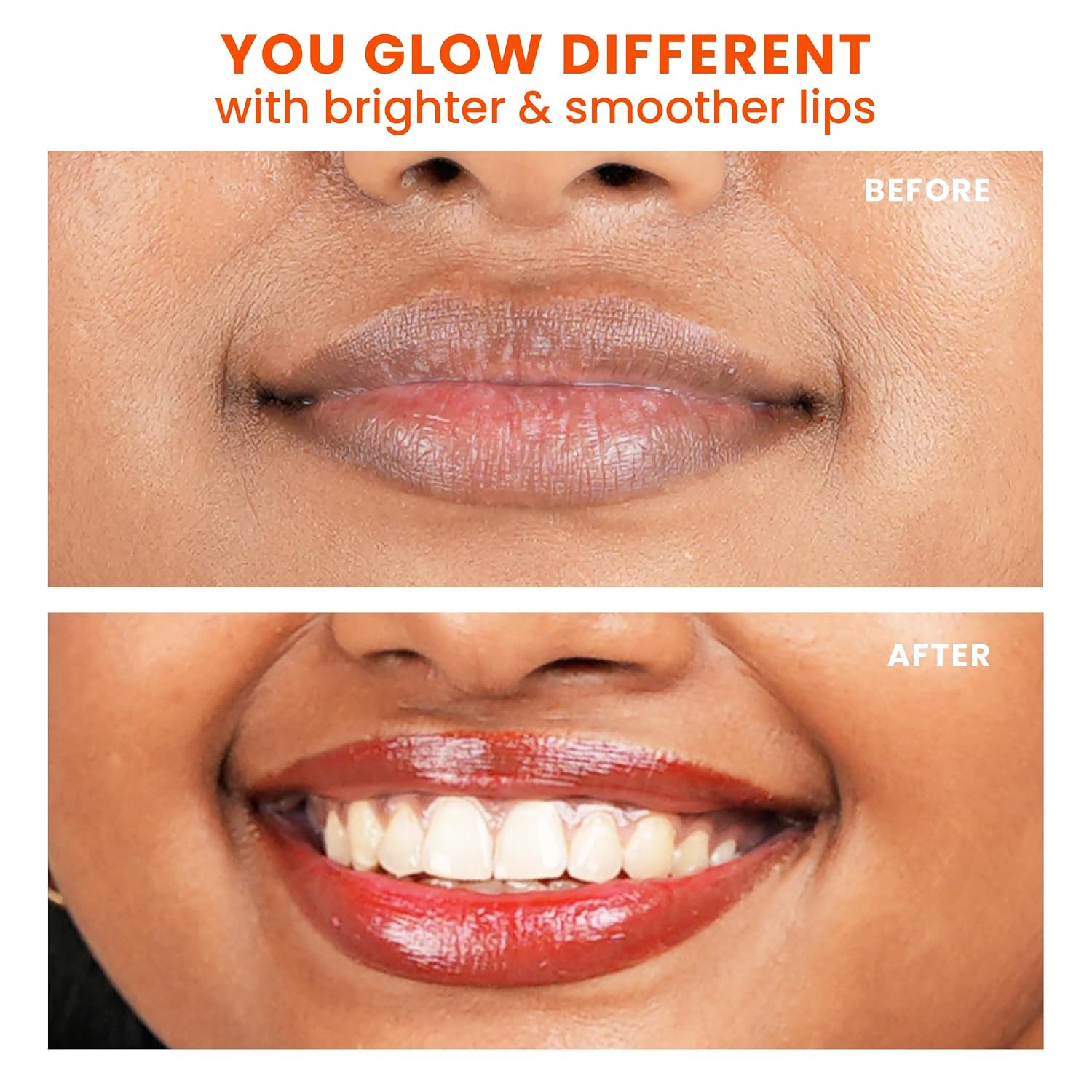 Foxtale SPF 30 Brightening Lip Balm for Dark Lips with Peptides & Vitamin C | Brightens Pigmented Lips | Hydrates Lip | SPF Lip Balm - Ruby Glaze 12gm