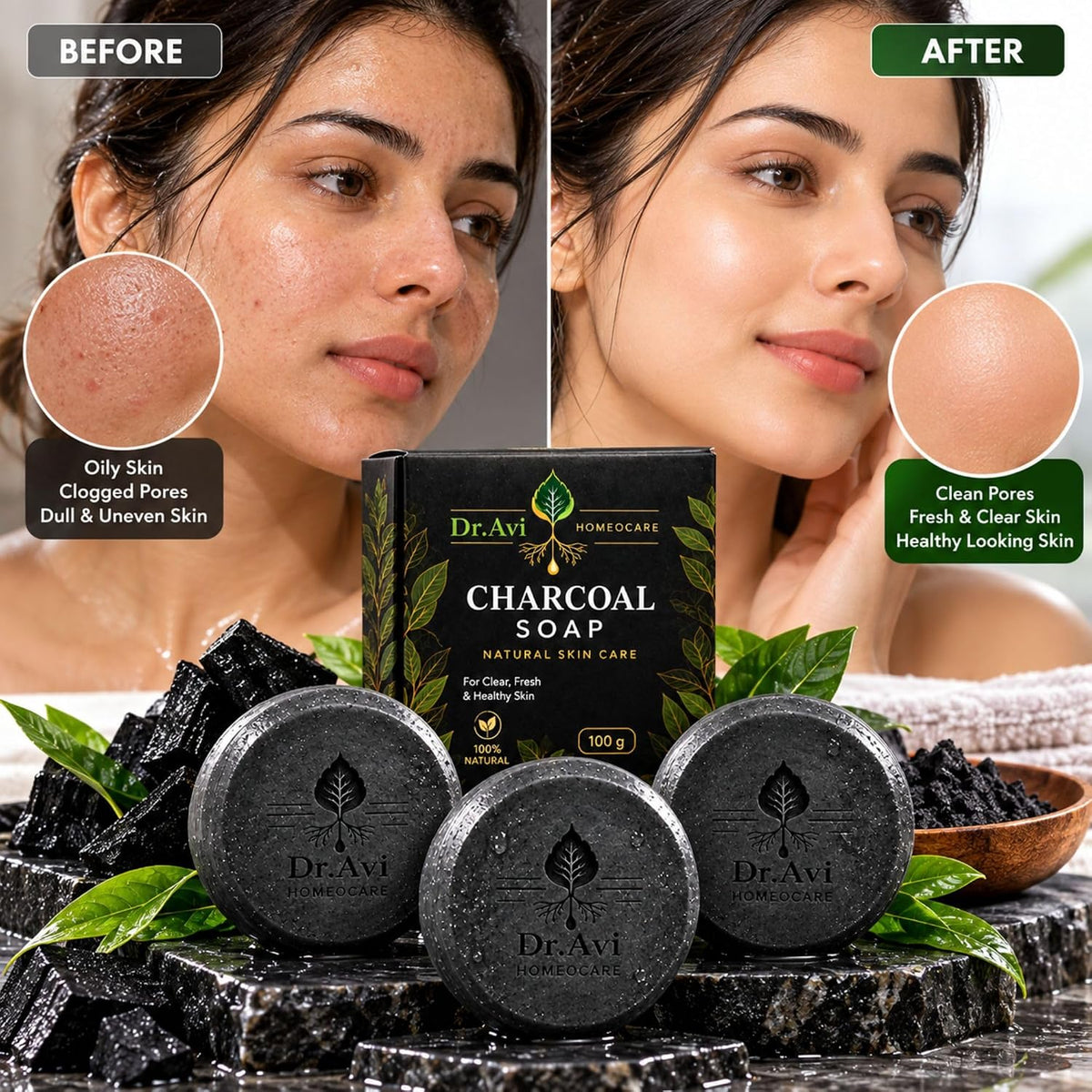 Dr. Avi Activated Charcoal Soap for Face & Body | Oil Control | 3 Bars Pack