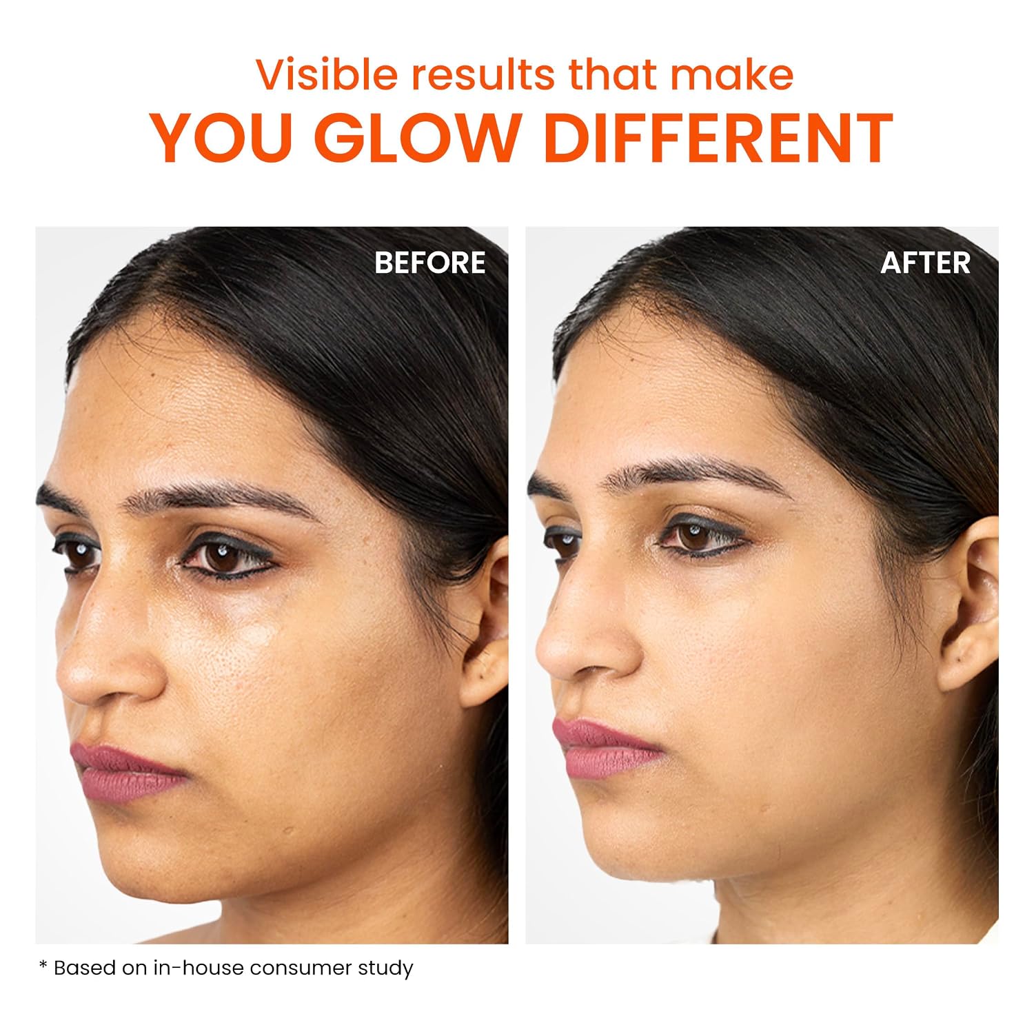 Foxtale Ice-Burst Gel Sunscreen SPF 50 PA++++ for Oily Skin, In-Vivo Tested & 100% New-Gen UV Filters | Prevents Tan, Controls oil, & Mattefies | Lightweight, Non-Greasy, No White Cast | For Men & Women | 50ml