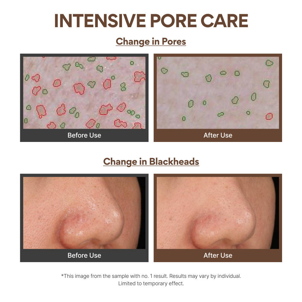 Innisfree Super Volcanic Pore Clay Mask 2X For Clogged Pores, Oil Control, Excess Sebum & Blackhead