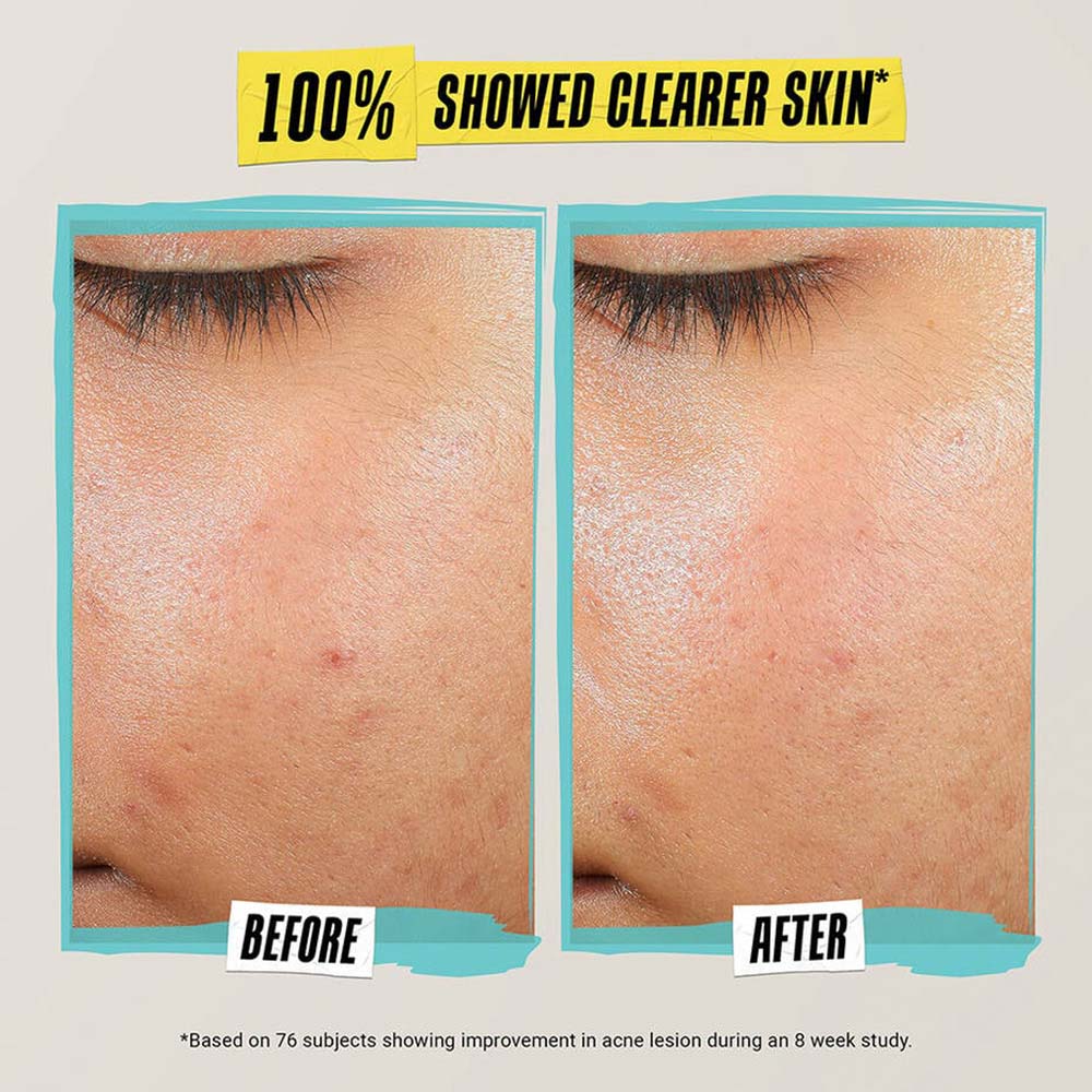 Kiehl's Expertly Clear Blemish-Treating & Preventing Lotion (60ml)