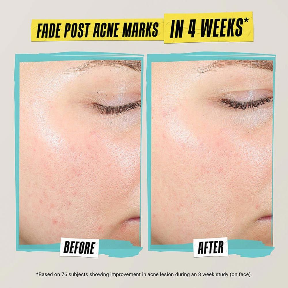 Kiehl's Expertly Clear Blemish-Treating & Preventing Lotion (60ml)