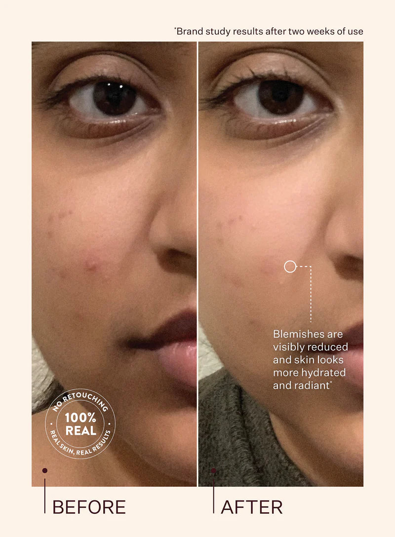 Peach & Lilly Glass Skin Refining Serum