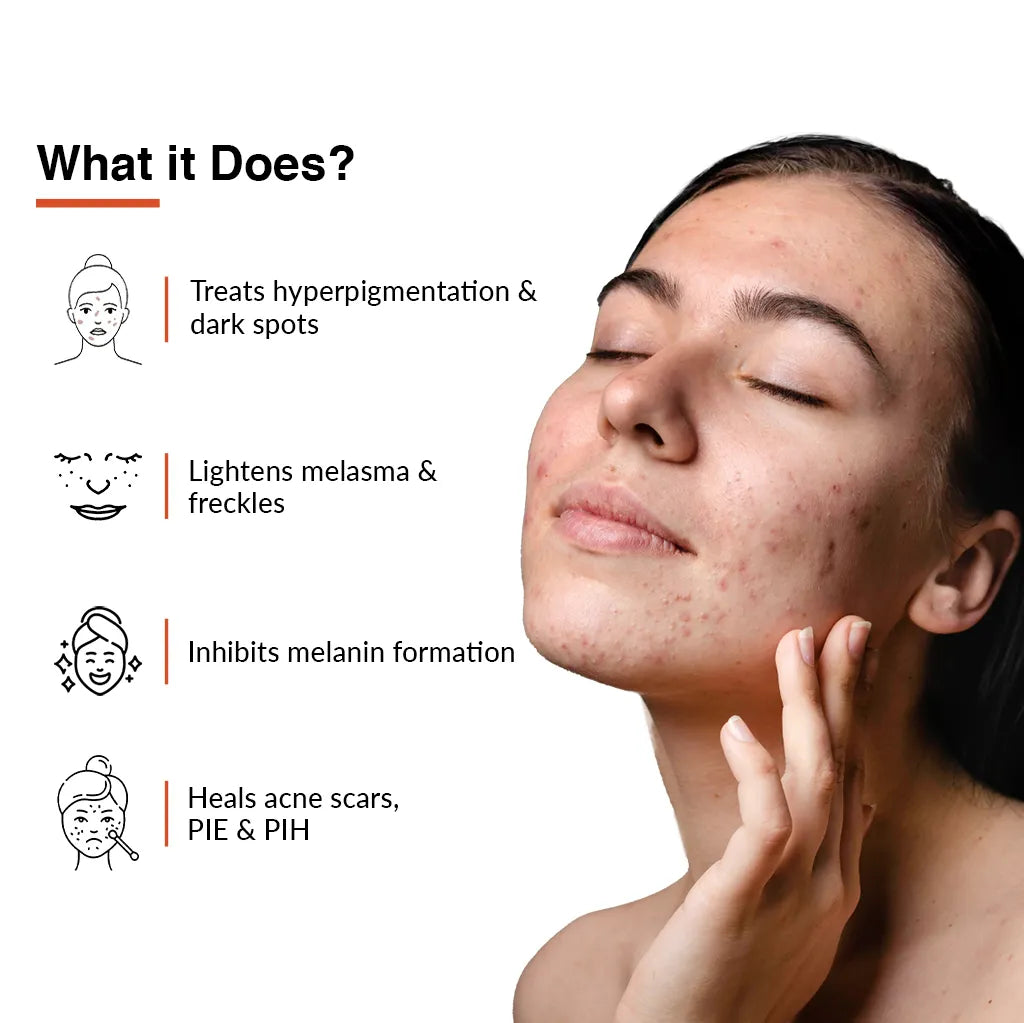 Fix Derma - Skarfix-TX For Melasma Treatment 10% Tranexamic Acid, 1% Vitamin C (15g)
