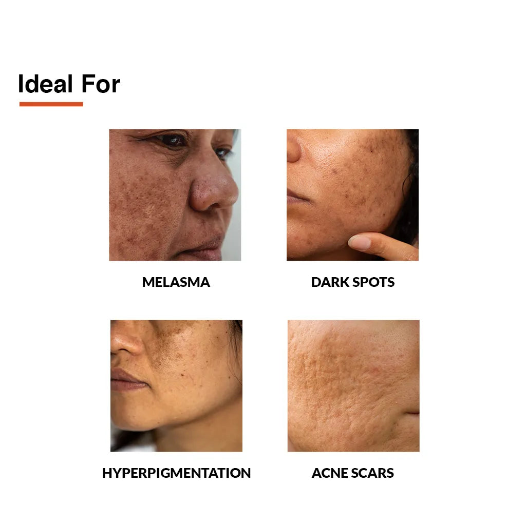 Fix Derma - Skarfix-TX For Melasma Treatment 10% Tranexamic Acid, 1% Vitamin C (15g)