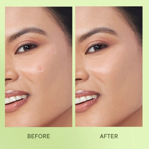 Quench - Zit Away Treatment Patches With Cica Herb Repair (24 Patches)