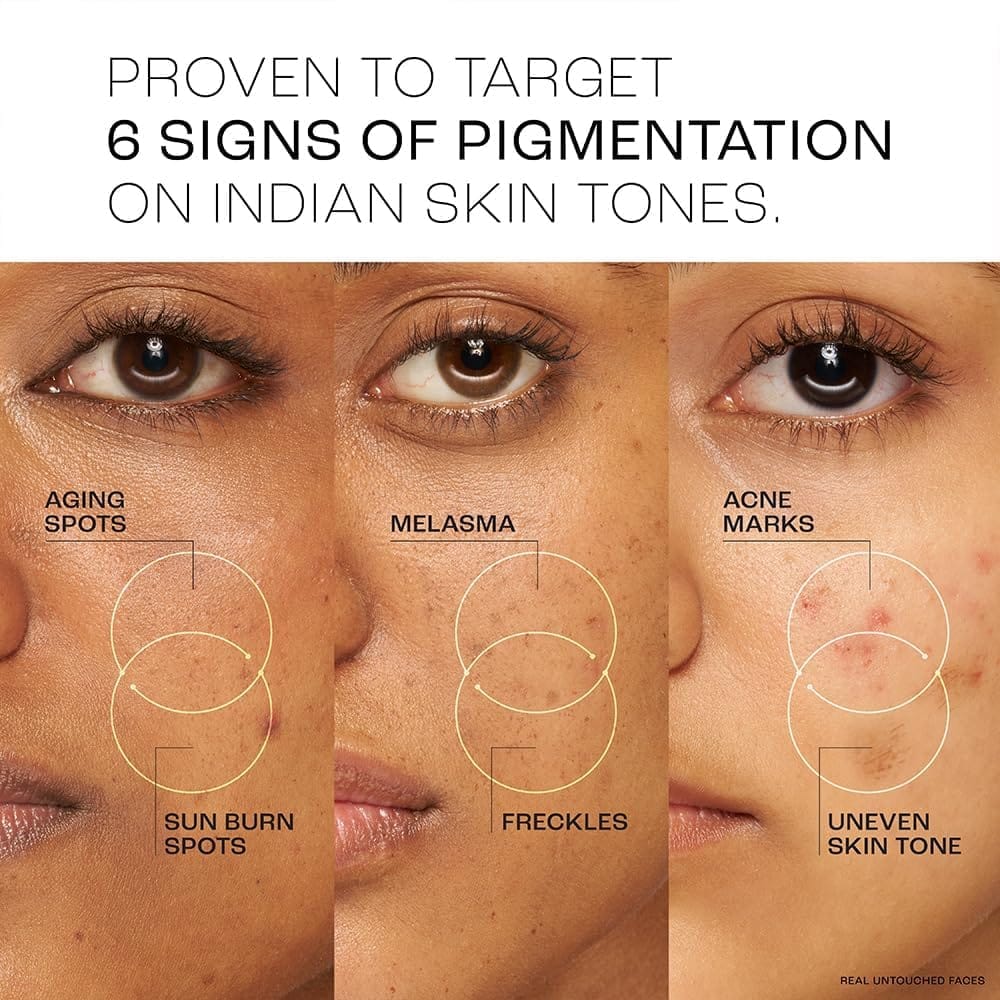 Lakme - Skin Ultime Collection Perfect Radiance Pigmentation Treatment Serum 15% Niacinamide (30ML)