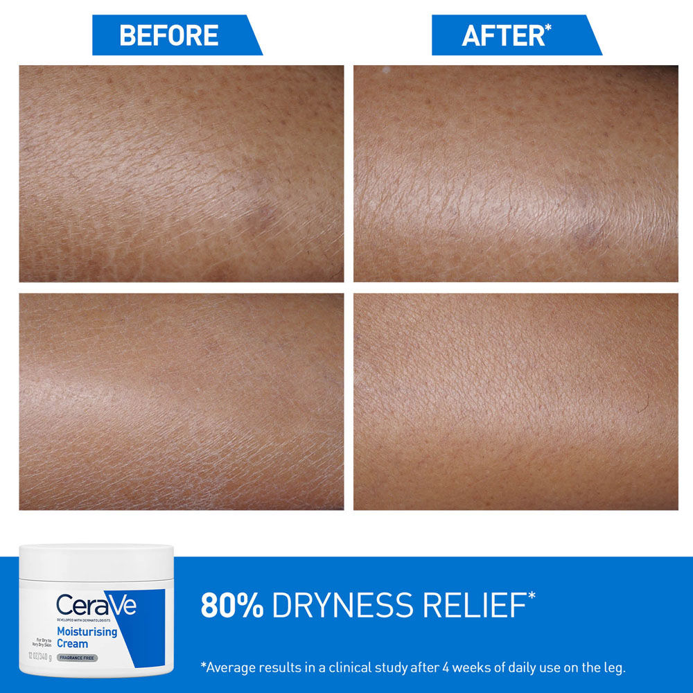 CeraVe Moisturizer For Dry Skin, Barrier Repair Cream with Ceramides, Dermatologist recommended (340 g)