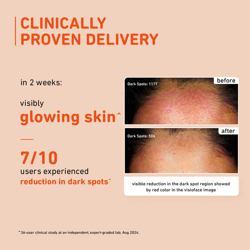 Plum Mandarin & 15% Vitamin C Glow Face Serum Dermat Tested To Fight Dark Spots & Dull Skin (30ml)