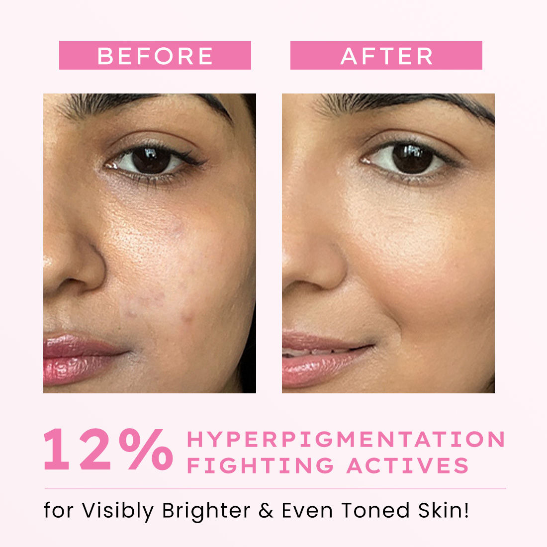 Hyphen Advanced De-Pigmentation Serum (30ml)