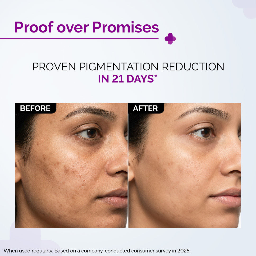 The Derma Co 2% Kojic Acid Face Serum for Dark spots reduction, Pigmentation & Blemishes (30ml)