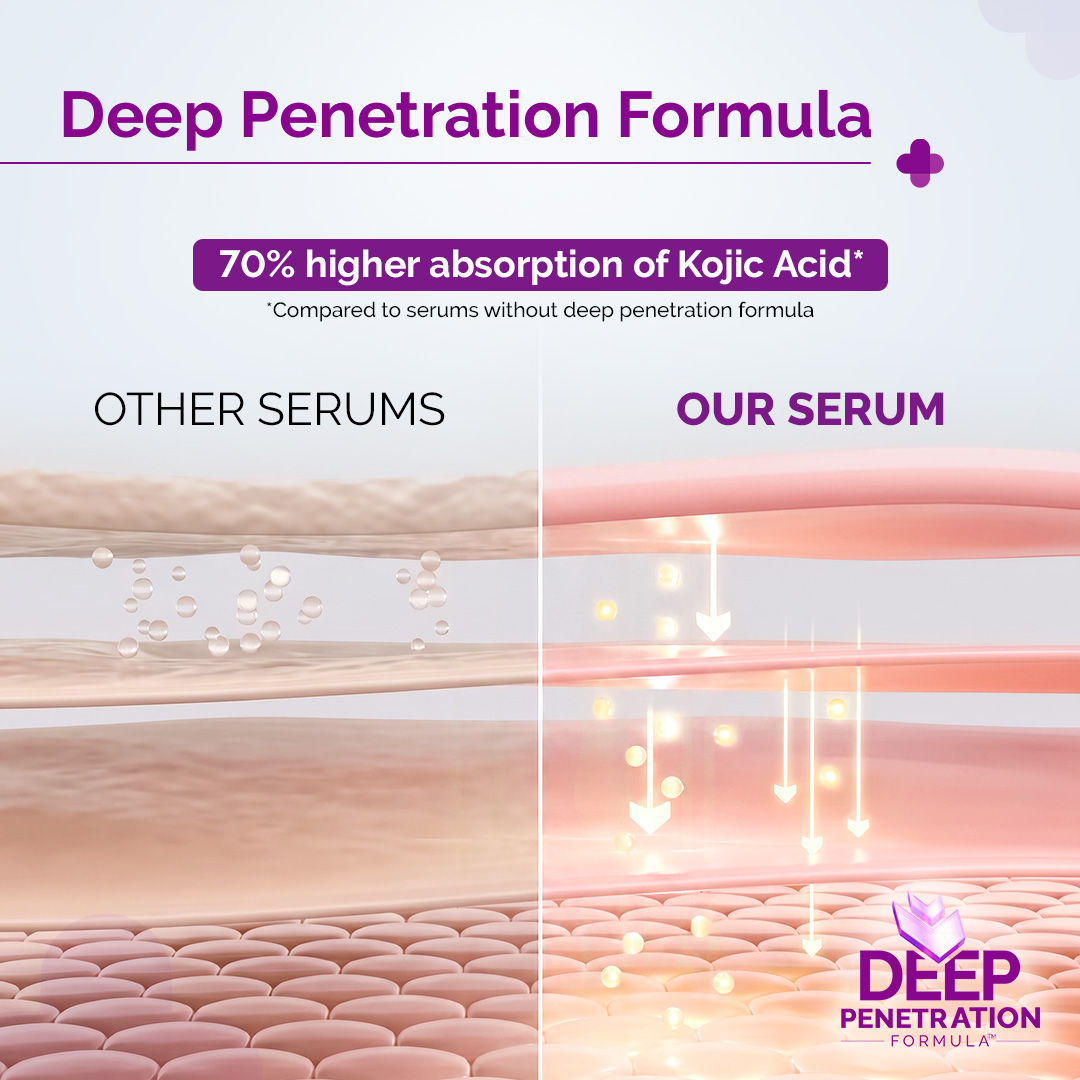 The Derma Co 2% Kojic Acid Face Serum for Dark spots reduction, Pigmentation & Blemishes (30ml)