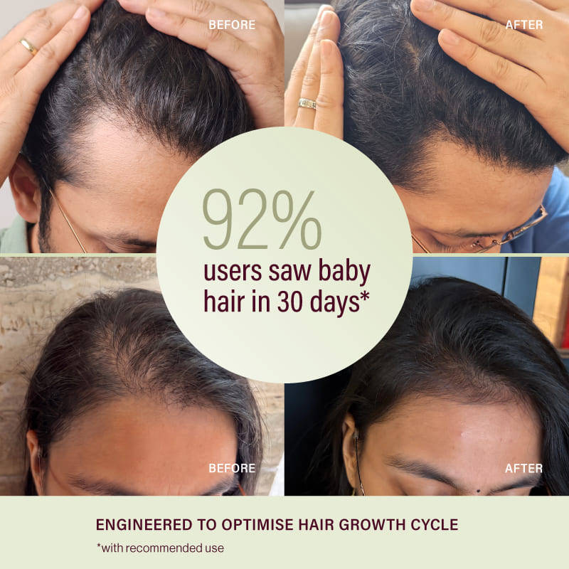 &Done Multi-Peptide Deep Absorbing Hair Growth Serum