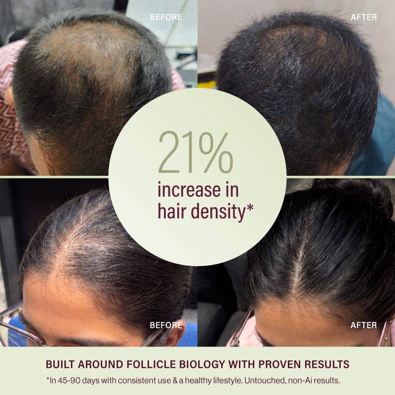 &Done Multi-Peptide Deep Absorbing Hair Growth Serum