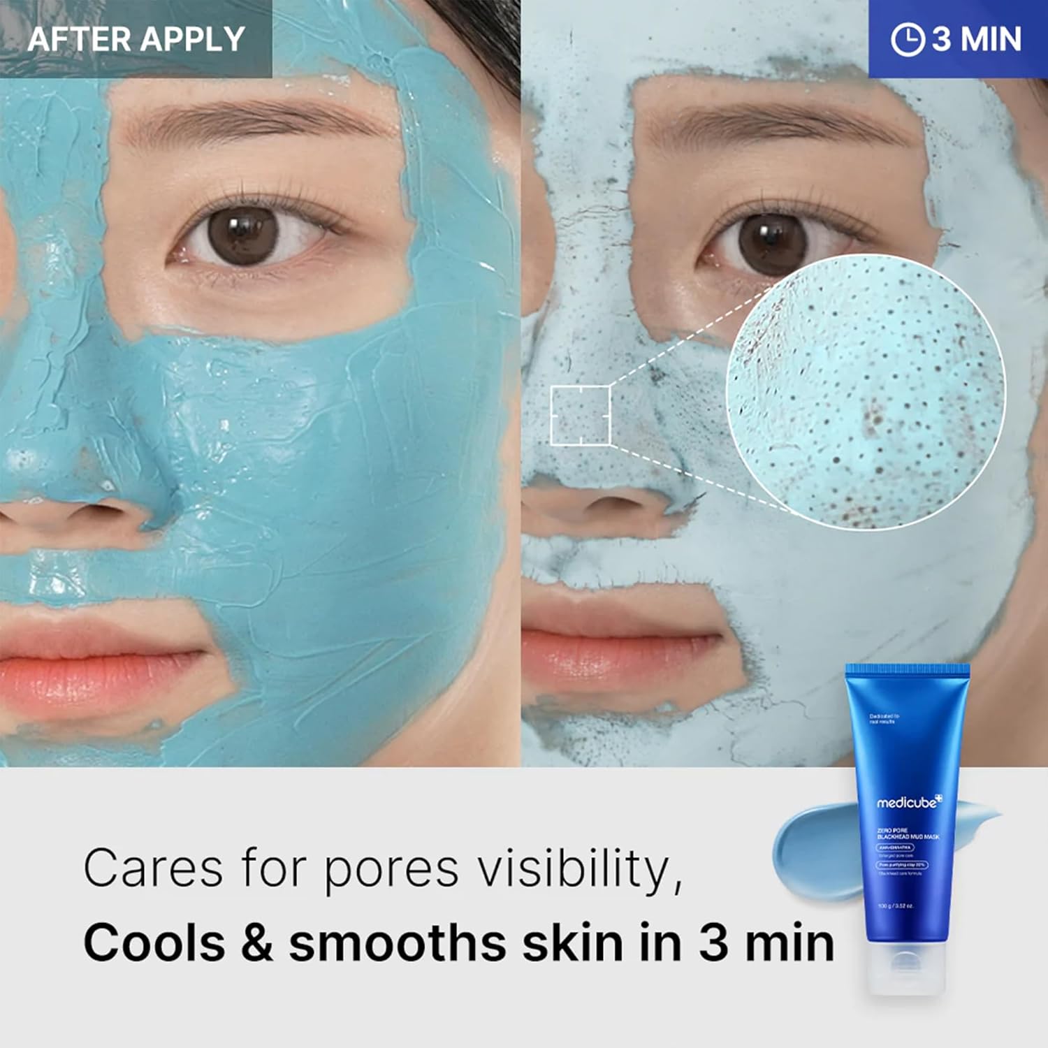 Medicube - Zero Pore Blackhead Mud Mask AHA + BHA + PHA (100g)