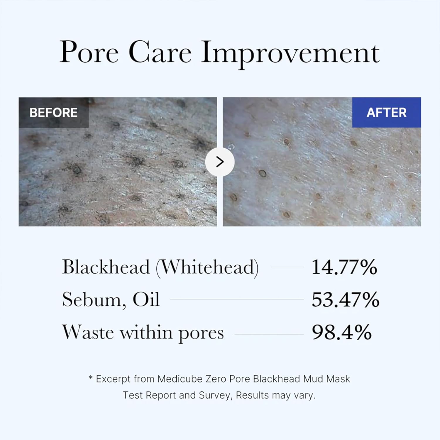 Medicube - Zero Pore Blackhead Mud Mask AHA + BHA + PHA (100g)