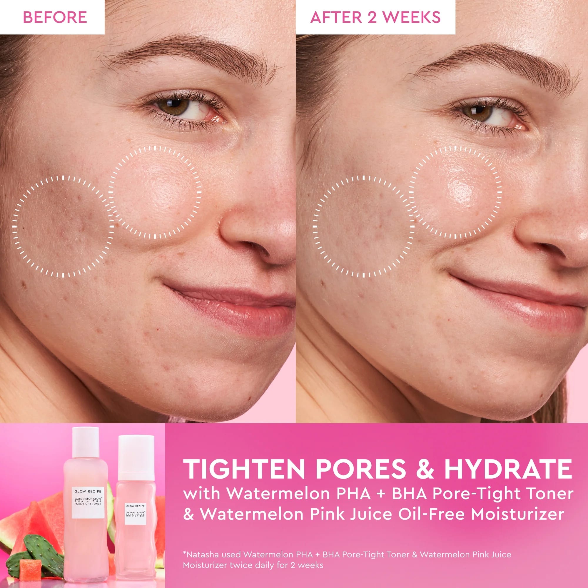 Glow Recipe - Watermelon Glow Dewy Skin Routine