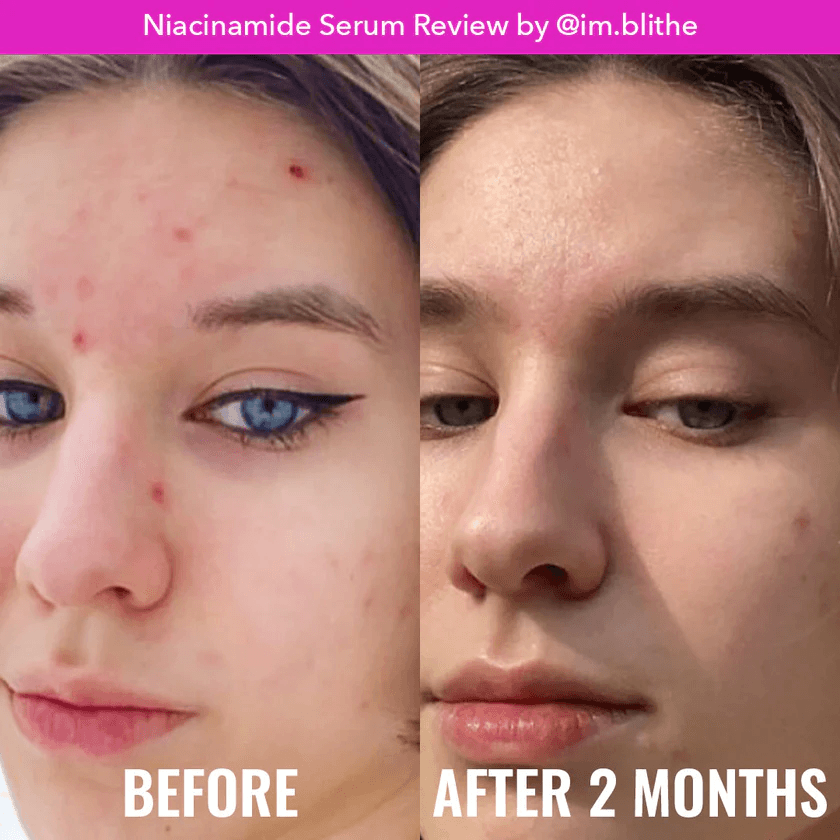 Good Molecules - NIACINAMIDE SERUM (30mL)